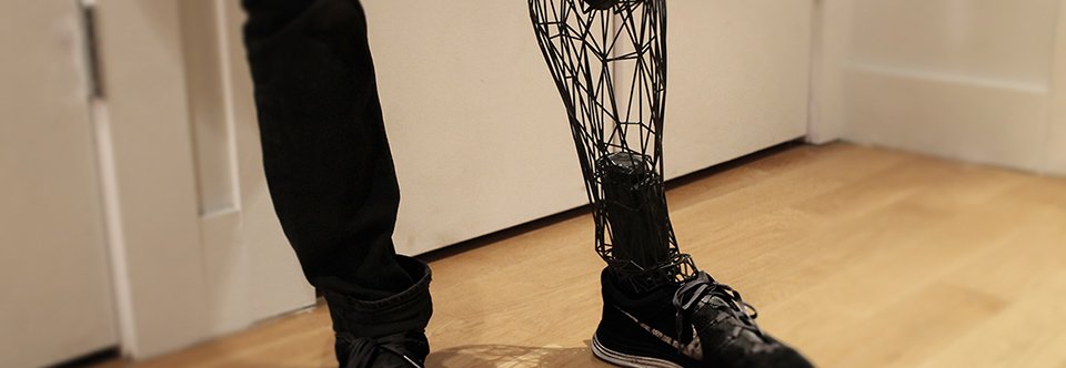 Biomechanical Prosthetics